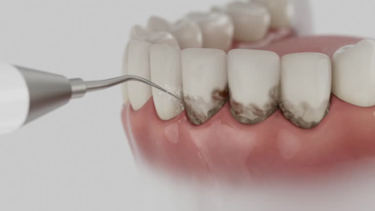 Trusted Tooth Extraction service in Crooks, SD - Dentist Open Now